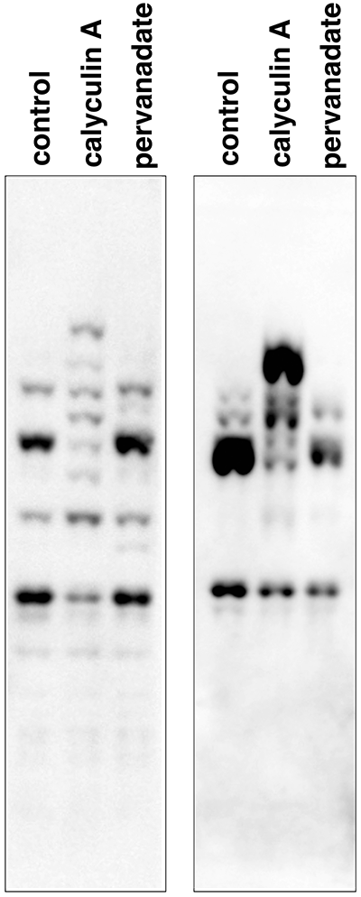 GSK3b